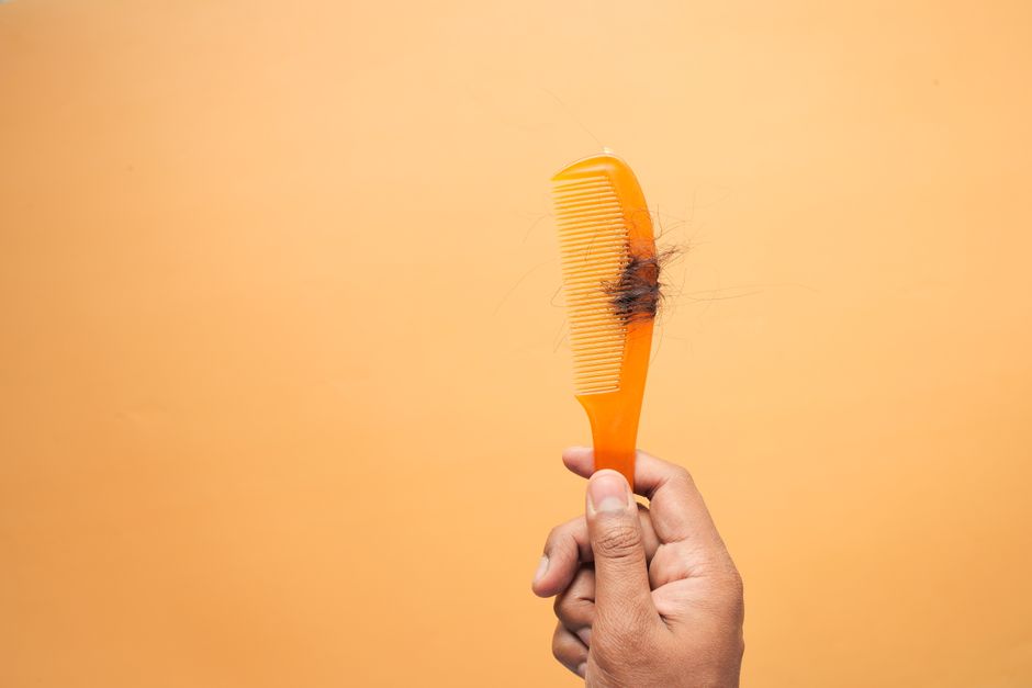 Is Minoxidil Shedding Normal or a Reason to See a Doctor?